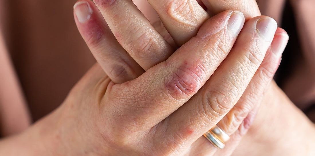 Nickel, Fading and Green Skin: The Real Risks of Fake Jewellery